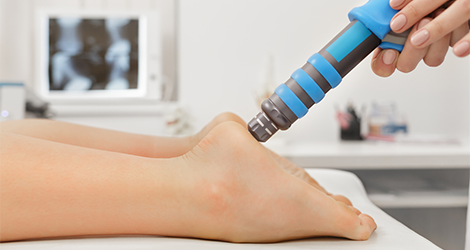 Harnessing the Power of Shockwave Therapy at Bramalea Physiotherapy