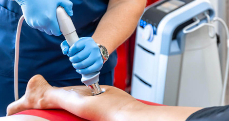 Benefits of Shockwave Therapy in Physiotherapy Treatment